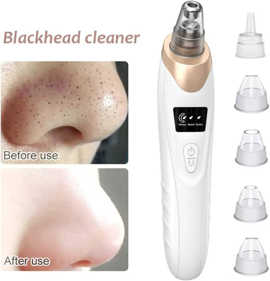 5-in-1 Rechargeable Blackhead Remover Machine – Pore Cleaner & Skincare Device